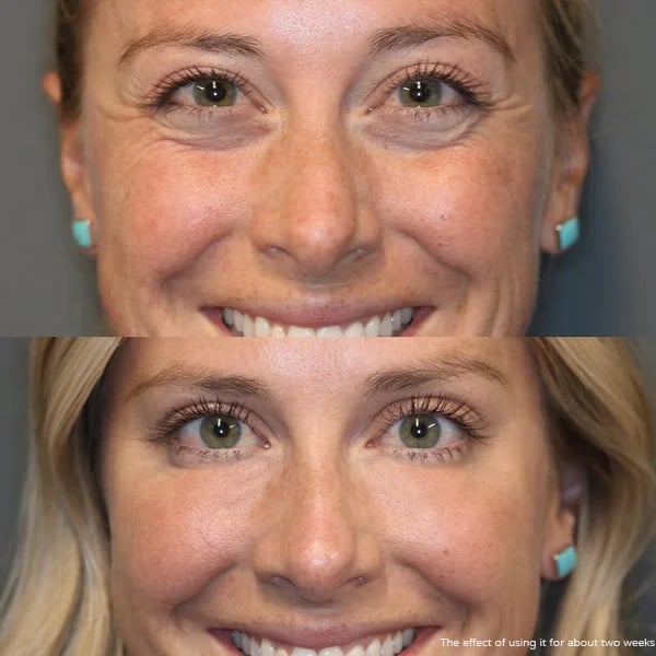 Retinol eye cream stick