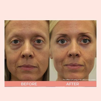Retinol eye cream stick