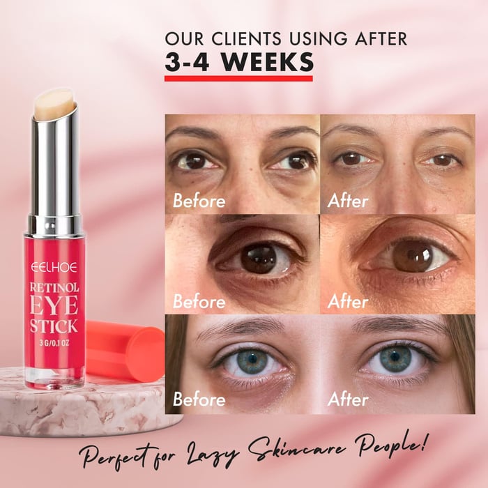 Retinol eye cream stick