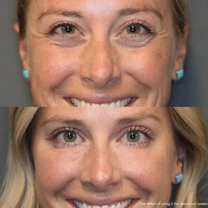 Retinol eye cream stick