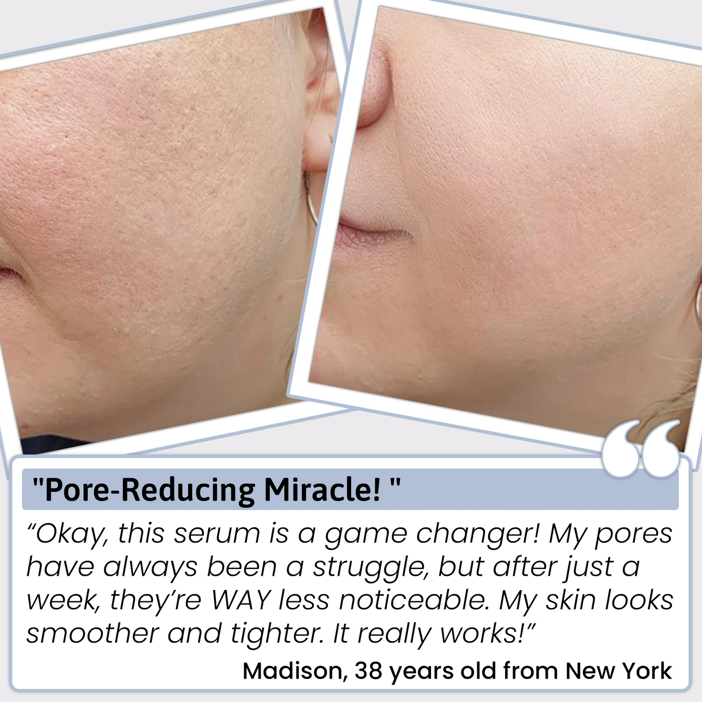 Varche 3% Hyaluronic Acid Serum