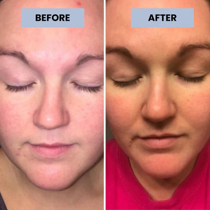 Varche 3% Hyaluronic Acid Serum