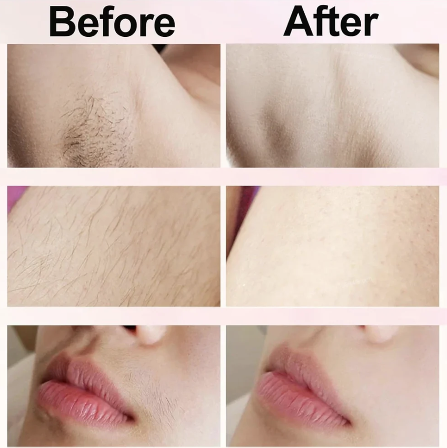 Varche 2 in 1 Women Body Shaver